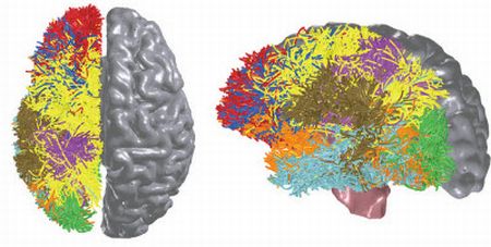 Reprodução tridimencional de cérebros